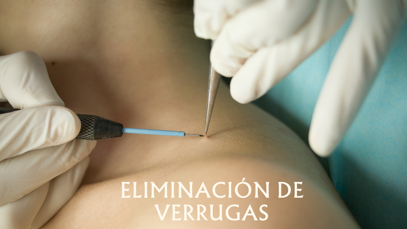 Otros servicios estéticos